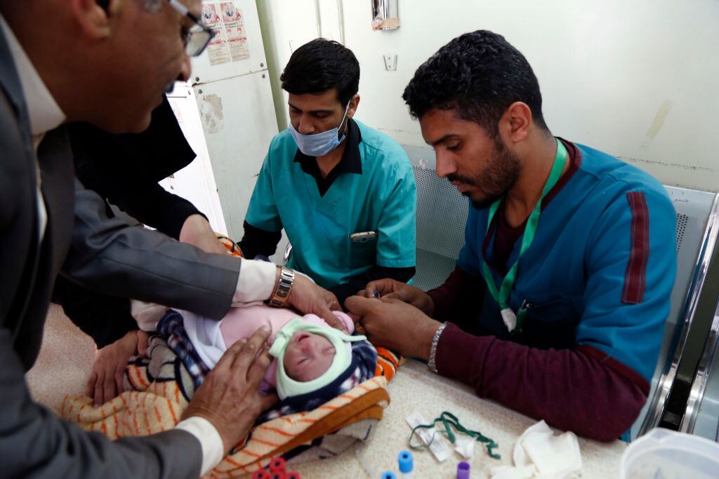 Médicos asisten a un bebé con problemas de alimentación en Yemen