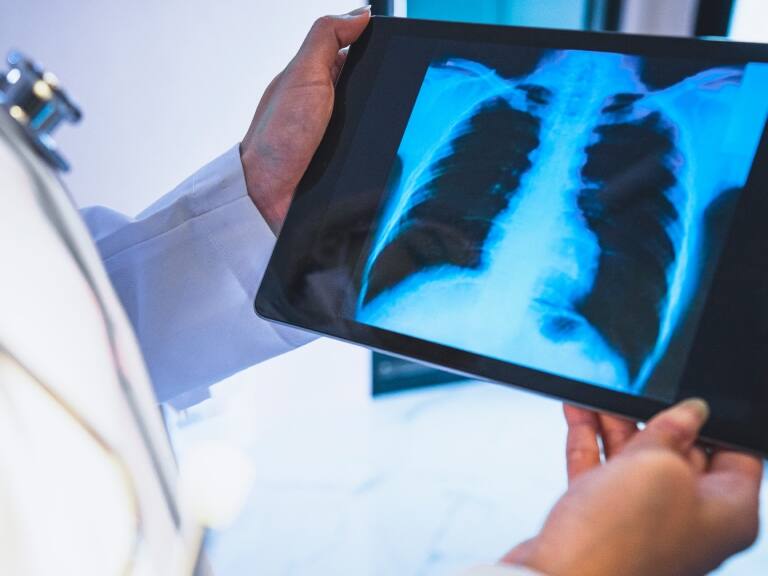 Minsal descarta brote de tuberculosis en La Florida tras presencia de casos en colegio de la comuna