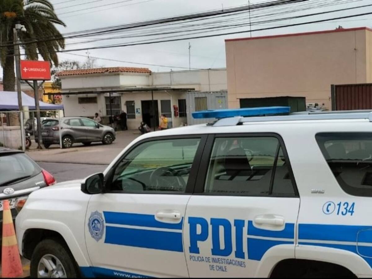 La Serena: víctima de femicidio frustrado termina casi con la mitad de su cuerpo quemado
