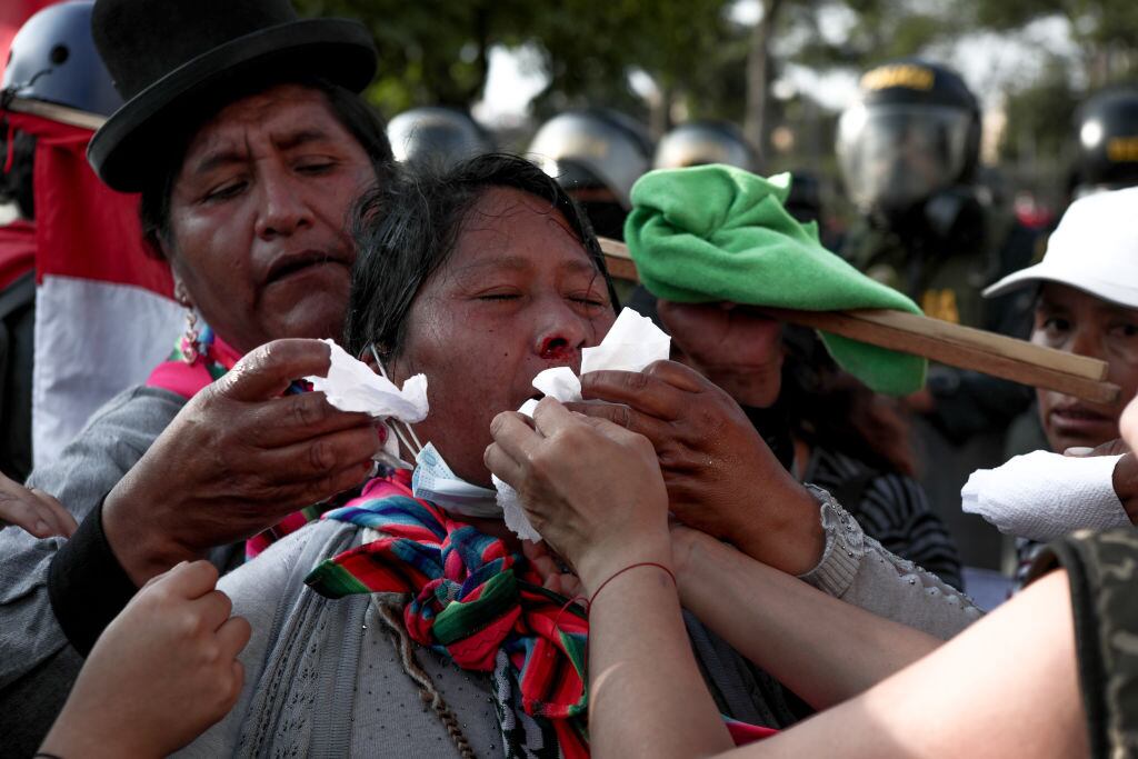 Mujer herida en medio de las protestas contra el gobierno en Perú