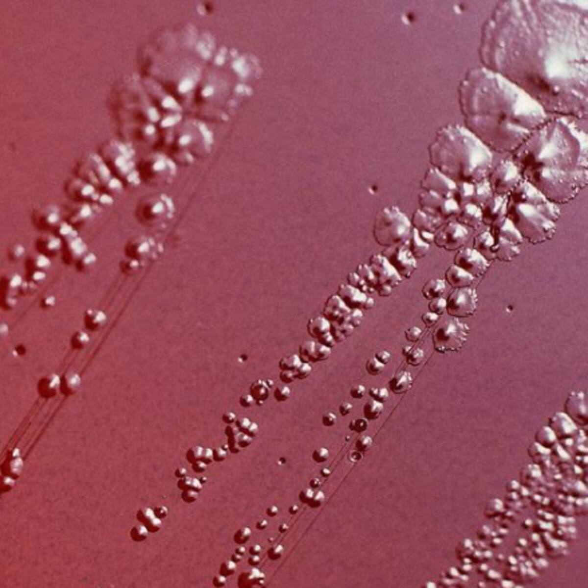Reino Unido lanza primer programa mundial de vacunas contra gonorrea