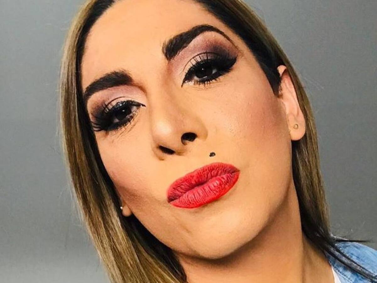Botota Fox mostró increíble antes y después tras bajar de peso