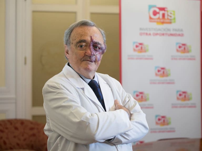 Escándalo en la ciencia: retiran estudio “milagroso” sobre el cáncer de páncreas por ocultar información