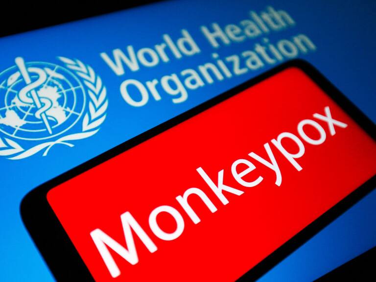 Imagen ilustrativa de la viruela del mono y la OMS