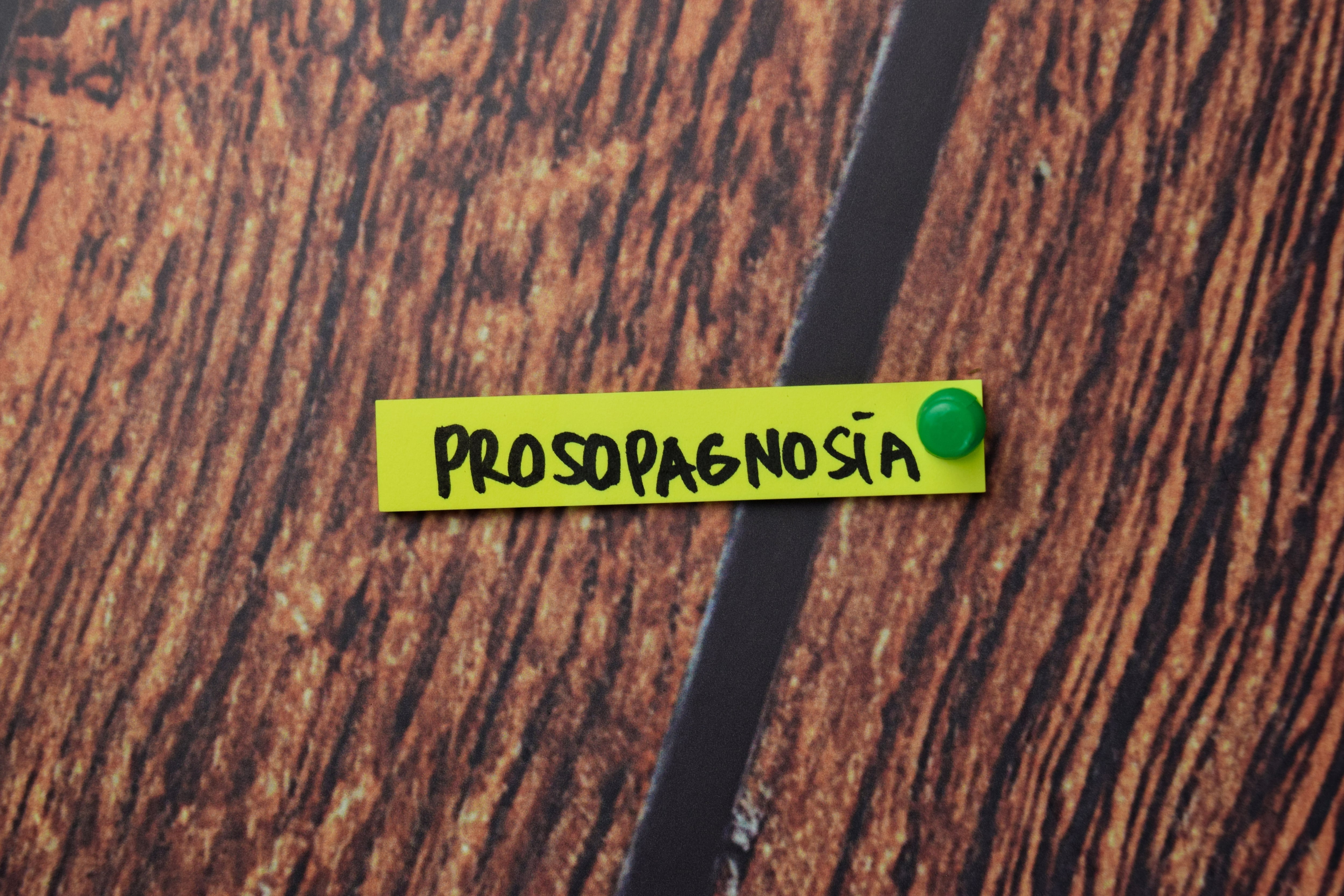 Prosopagnosia