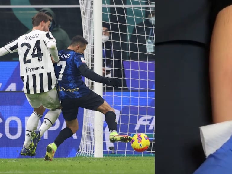 Hincha se tatuó el agónico gol de Alexis Sánchez contra Juventus por la Supercopa de Italia