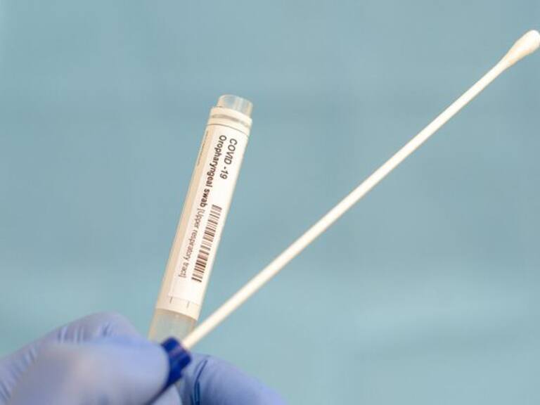 Minsal elevó a 270 las personas muertas por coronavirus Covid-19