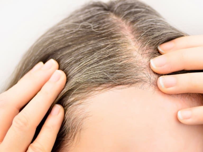 ¿Se pueden prevenir las canas? Esto es lo que dice la ciencia