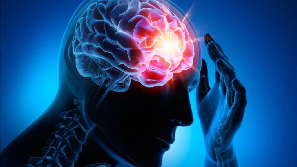 Accidente Cerebrovascular