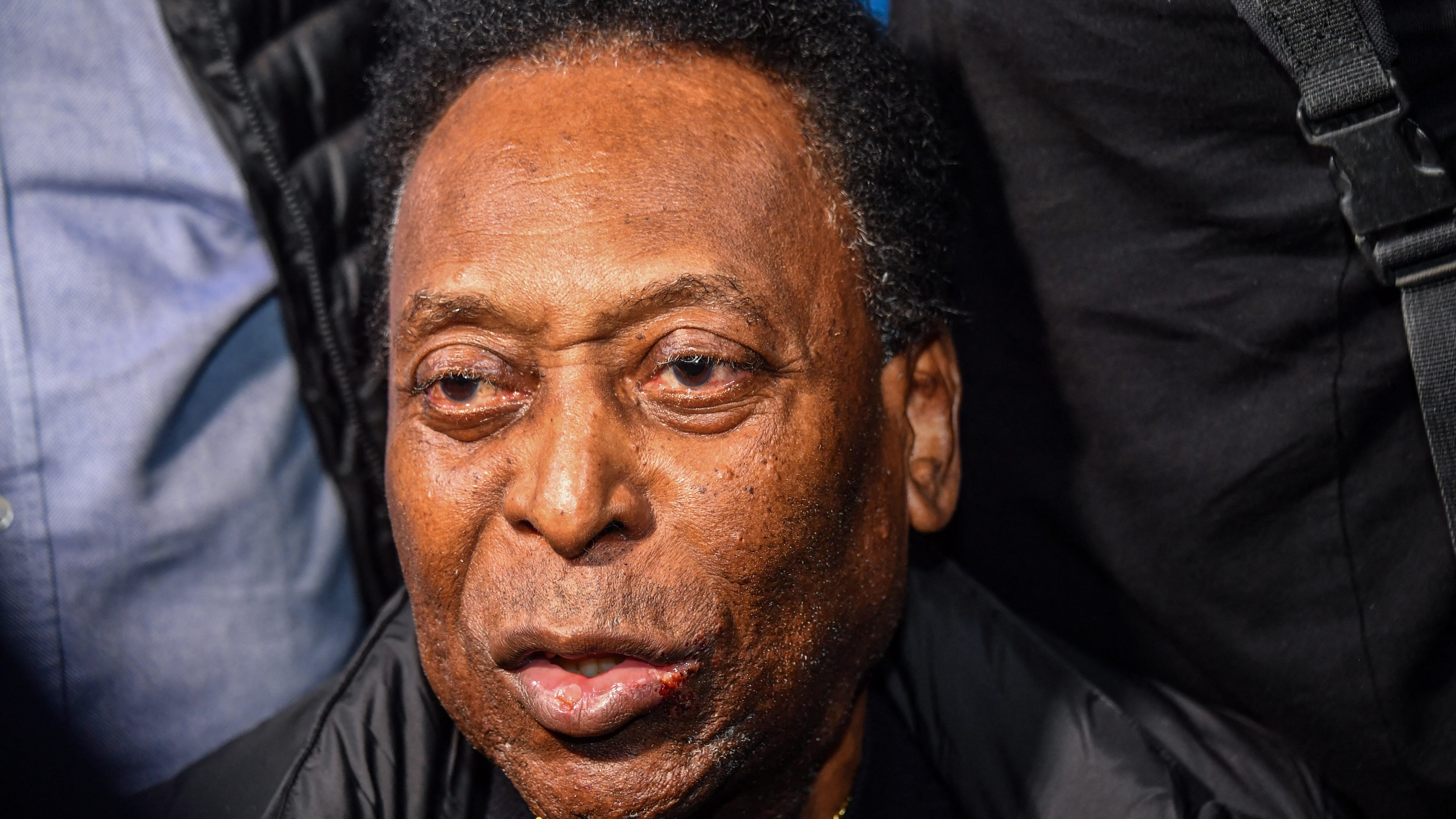 Pelé