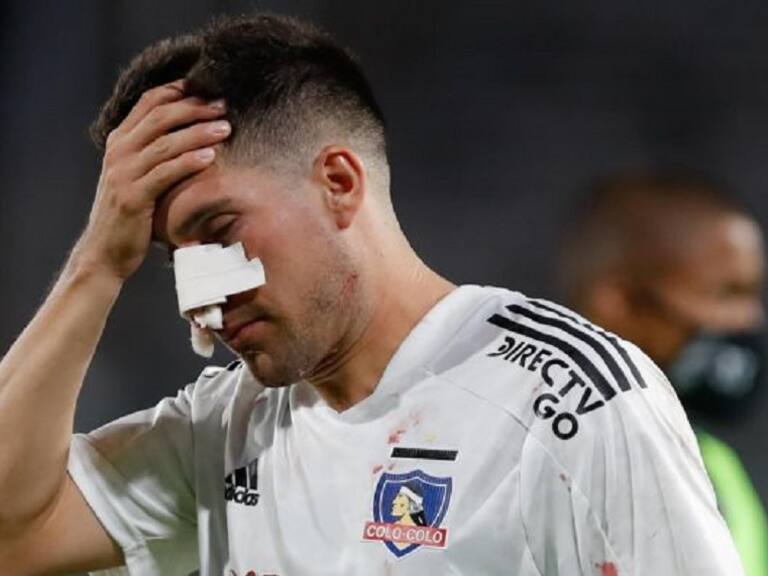 César Fuentes tendría fractura de nariz y su tiempo de baja dependerá si es sometido a una operación