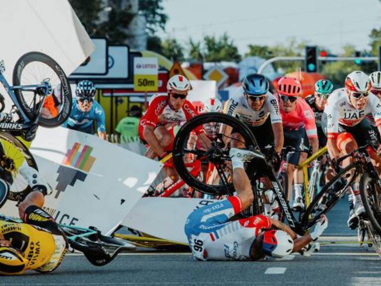 130 puntos en la cara y solo le queda un diente: Las secuelas del accidente de Fabio Jakobsen