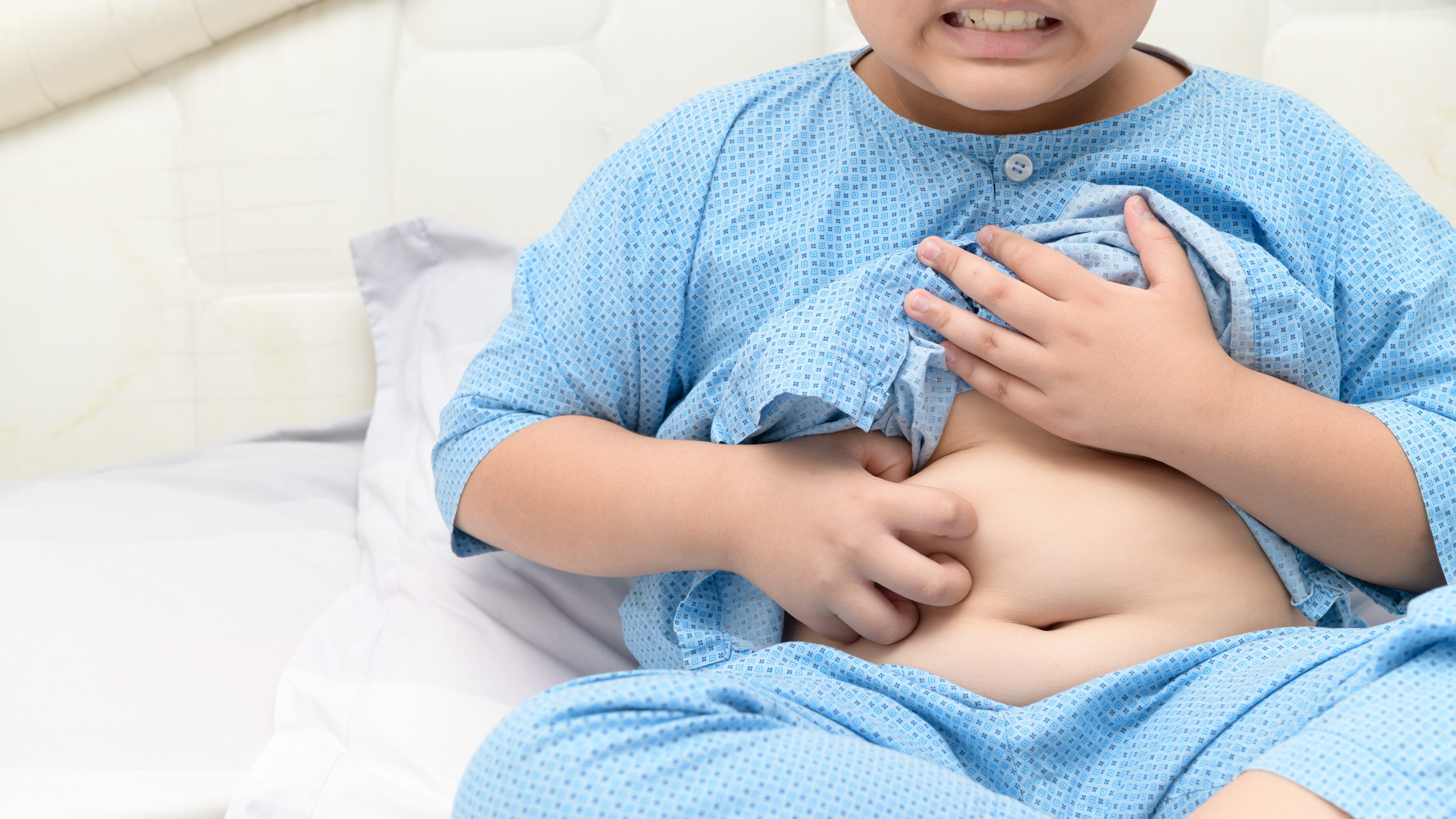 Obesidad infantil
