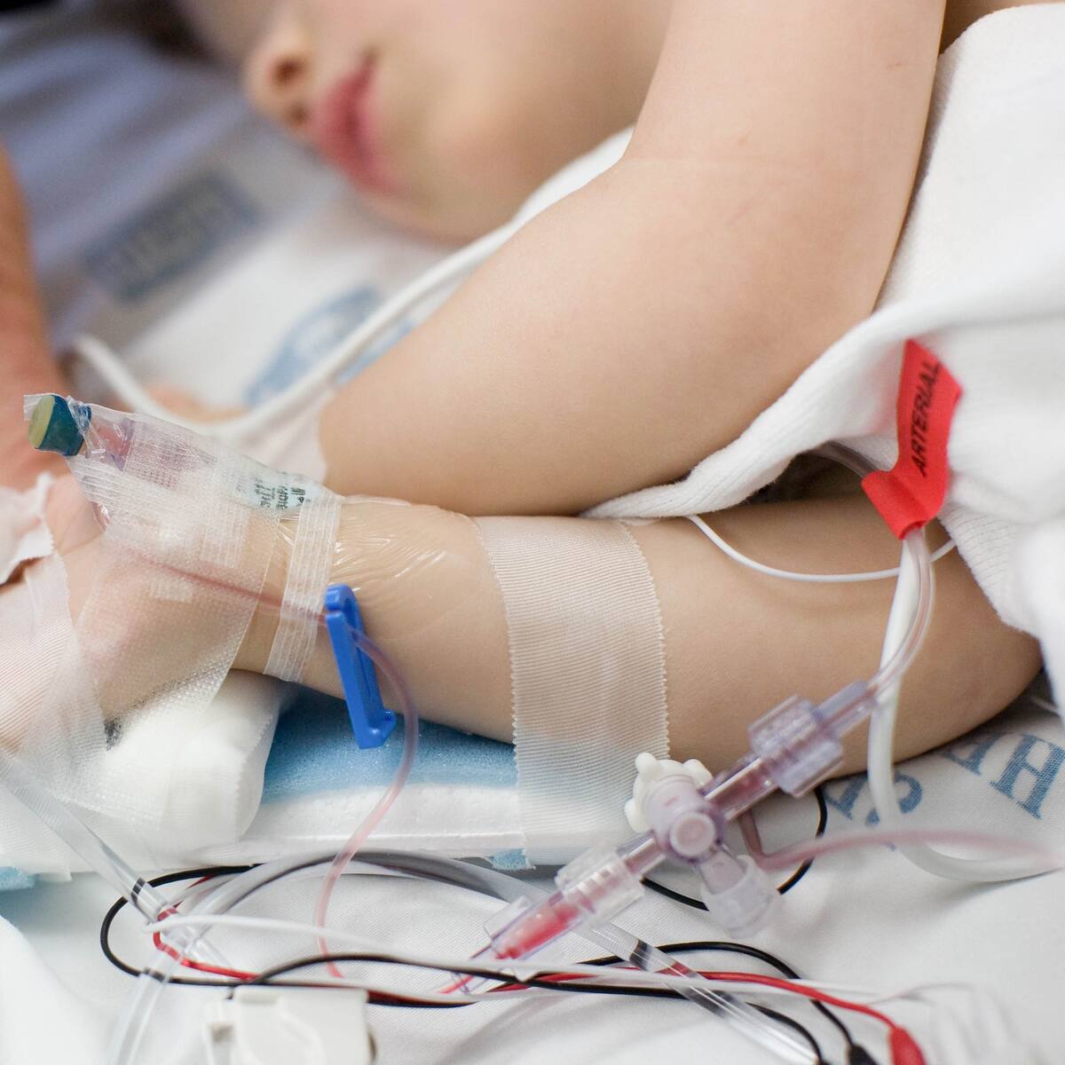 Alerta en Chile: 58% de los niños de 1 año sigue sin vacunarse en plena temporada de virus respiratorios
