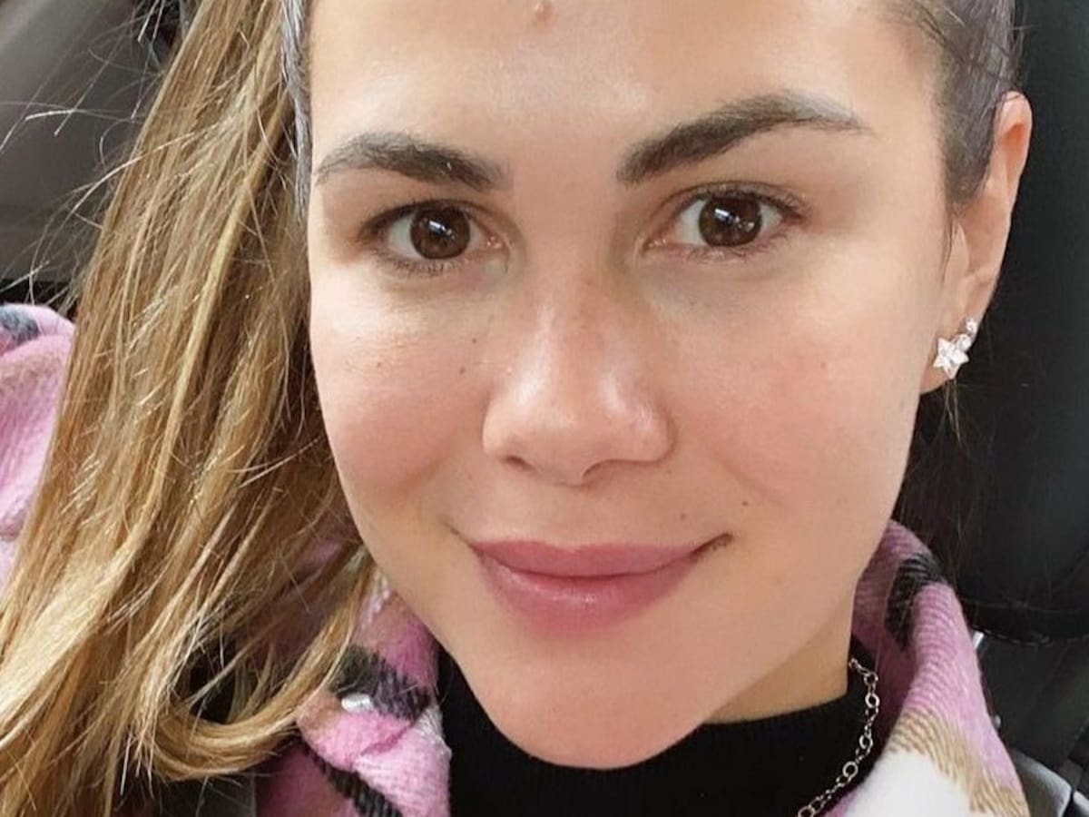 «¿Qué te hiciste en la nariz?»: Laura Prieto reconoció que se hizo procedimiento estético