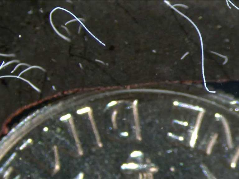 Imagen de la bacteria llamada Thiomargarita magnifica