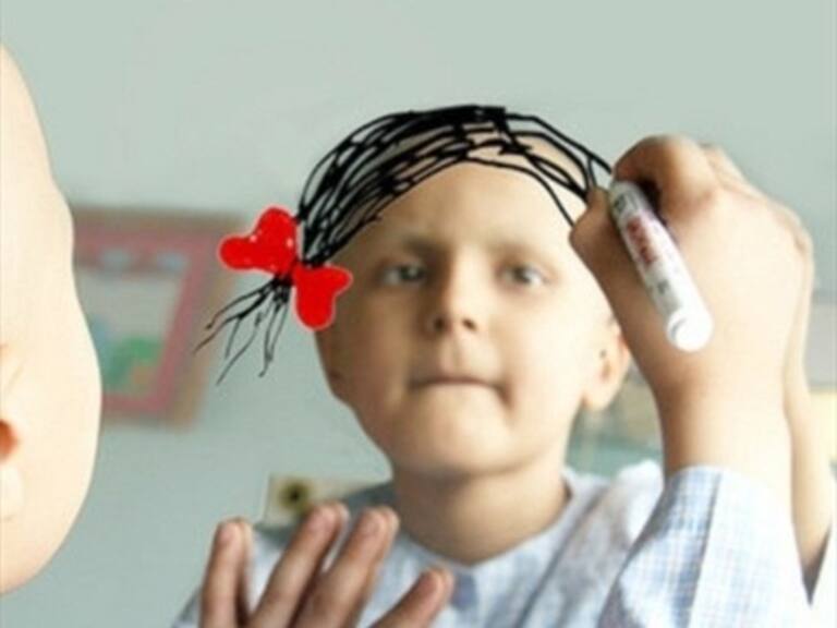Niño se dejó crecer el pelo por 2 años para donarlo a enfermos con cáncer