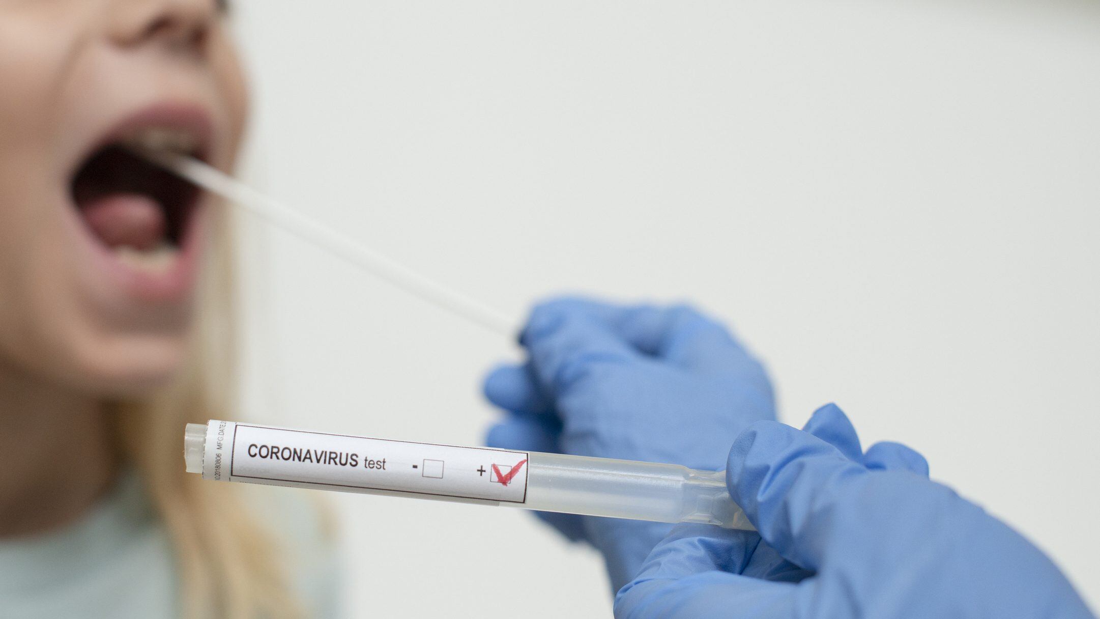 Coronavirus (COVID-19) is a respiratory illness caused by a new virus. Symptoms range from a mild cough to pneumonia