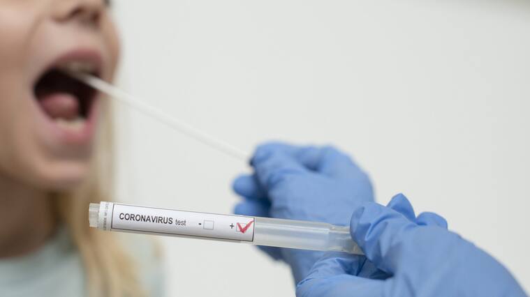 Coronavirus (COVID-19) is a respiratory illness caused by a new virus. Symptoms range from a mild cough to pneumonia
