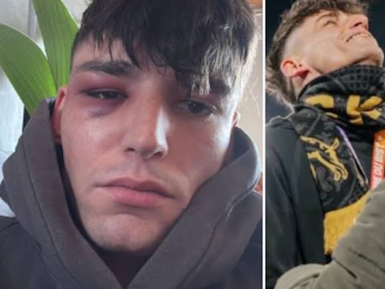 Grave ataque homofóbico en Alemania: árbitro de la Bundesliga es agredido en su casa tras pedir matrimonio a su novio