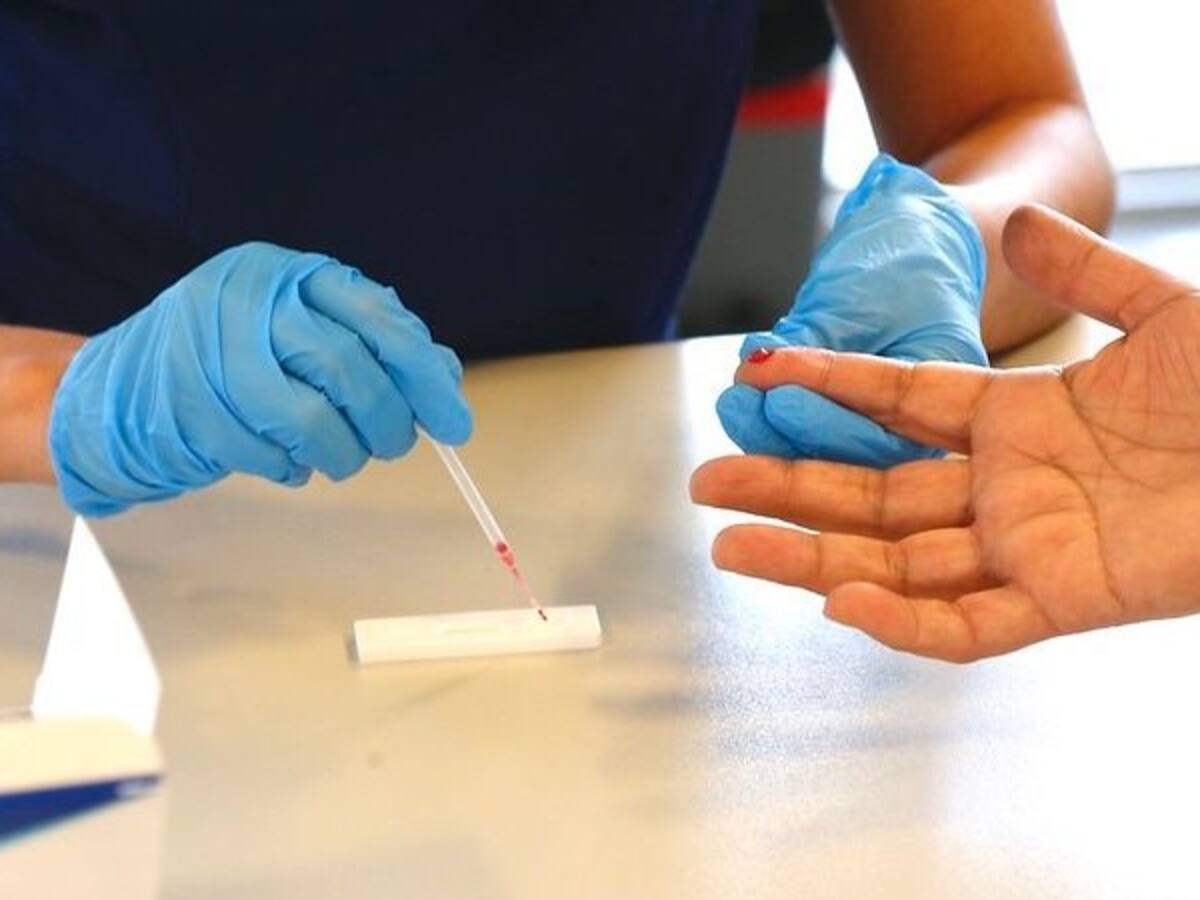 Iniciaron plan de aplicación de test rápidos para medición de anticuerpos del coronavirus Covid-19