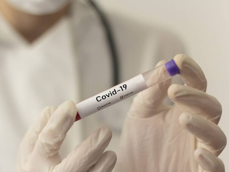 Perú registró mayor cifra de contagiados desde el inicio de la pandemia y superó los 80 mil casos confirmados