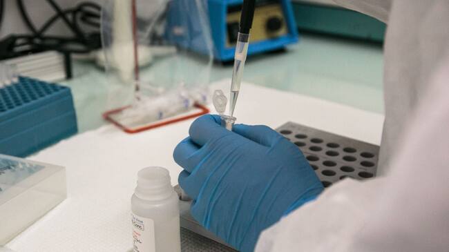 Examen PCR coronavirus Covid-19