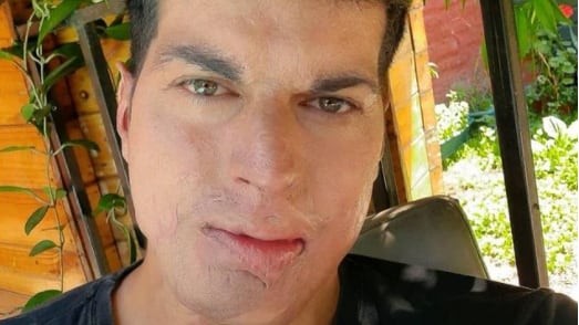 Ignacio Lastra | Instagram
