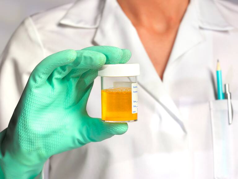 ¿Por qué la orina es amarilla? Investigadores de la Universidad de Maryland revelaron la razón