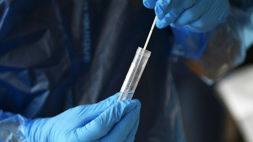 02 de julio de 2020 / IQUIQUEUna muestra es guardada en un tubo durante el examen realizado en el Terminal Agropecuario durante la cuarentena total por la emergencia sanitaria que ha provocado el coronavirus pandemia en todo el país .
FOTO: CRISTIAN VIVERO BOORNES/AGENCIAUNO