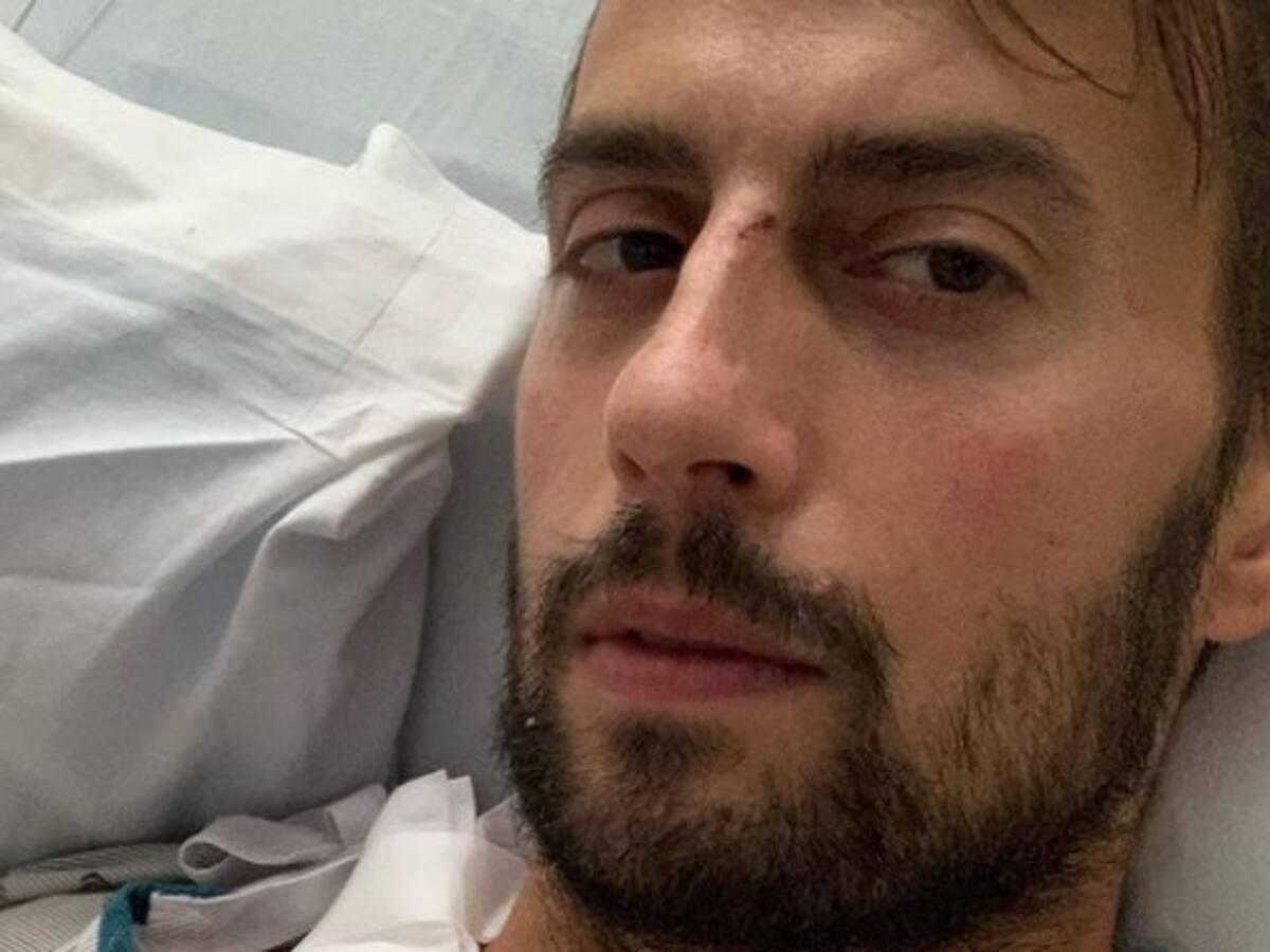 Paseador de perros de Lady Gaga tuvo que extirpar un trozo de su pulmón tras ser asaltado