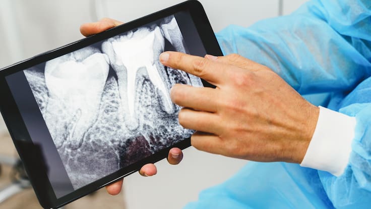 ¿Sabías que tu salud bucal afecta tu estado de ánimo? Esto explica la ciencia