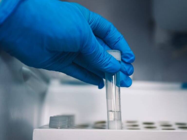 Balance Minsal: se reportaron 3.689 nuevos casos y 13 fallecidos por covid-19