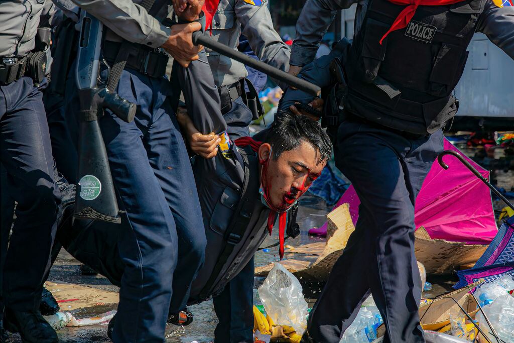 Un manifestante herido tras ser golpeado por la policía de Myanmar