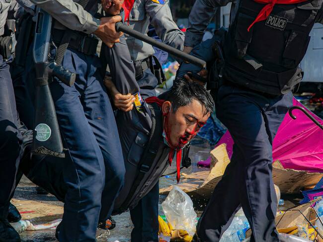 Un manifestante herido tras ser golpeado por la policía de Myanmar