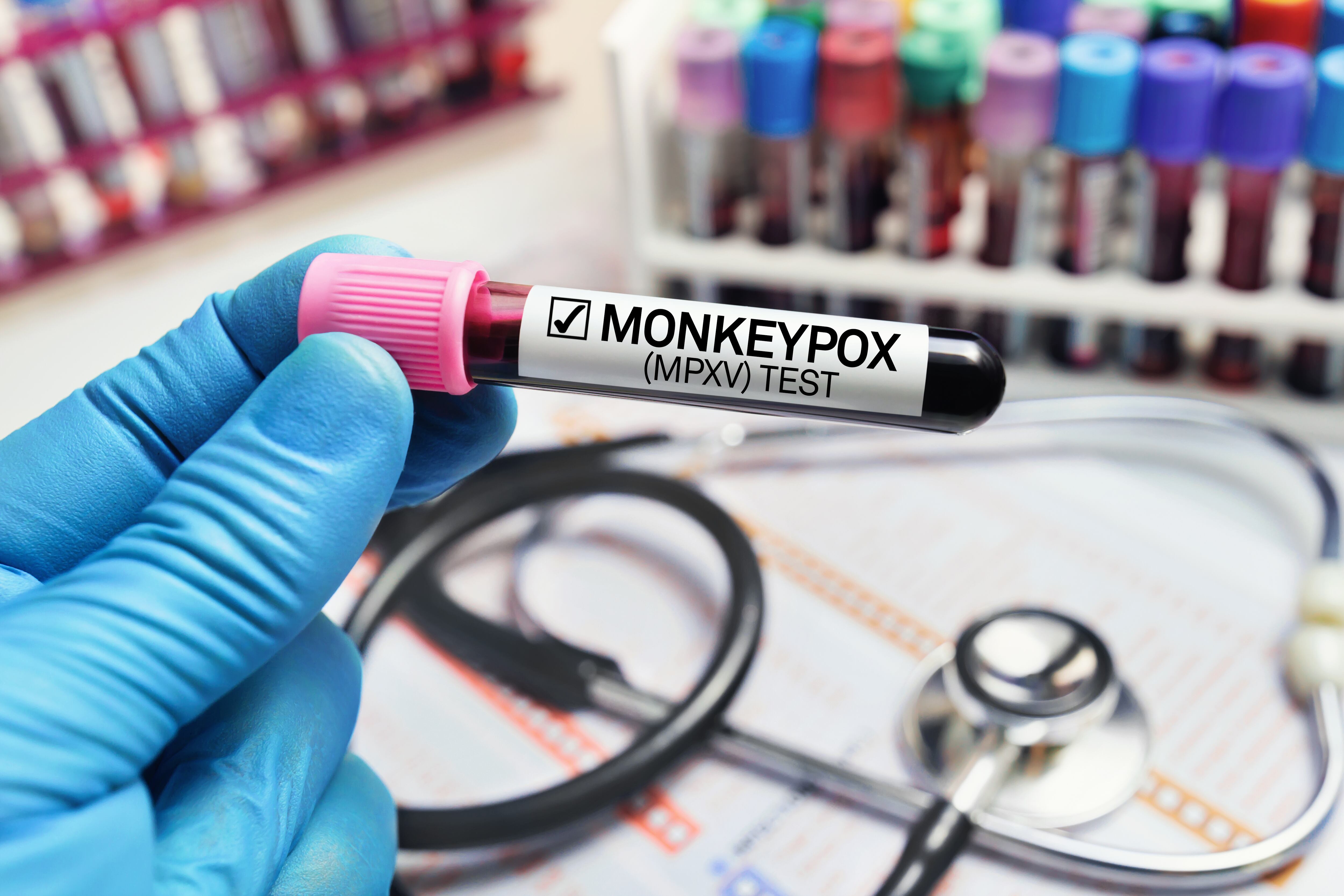 Monkey pox virus (MPXV)