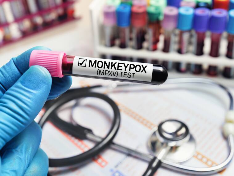 Monkey pox virus (MPXV)