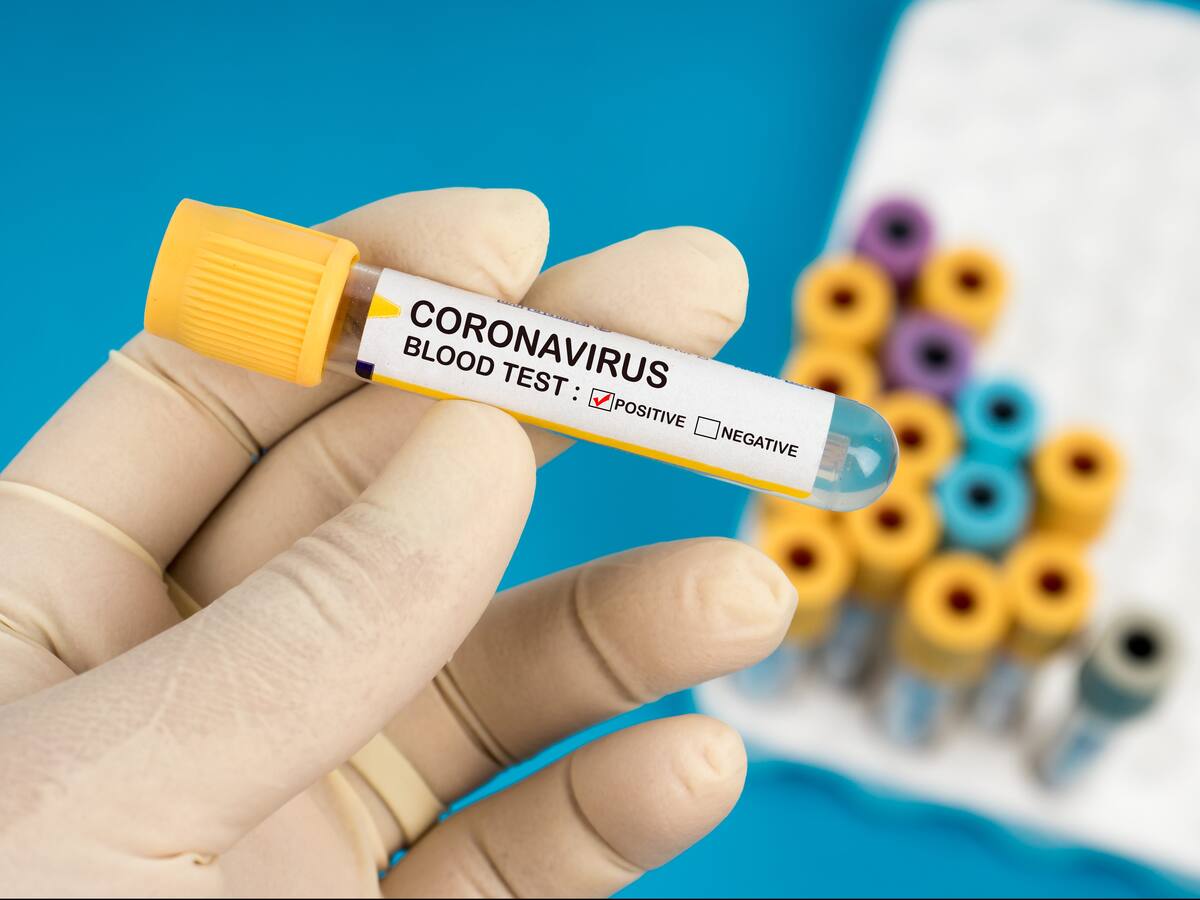 Confirmaron quinto caso de coronavirus en Chile