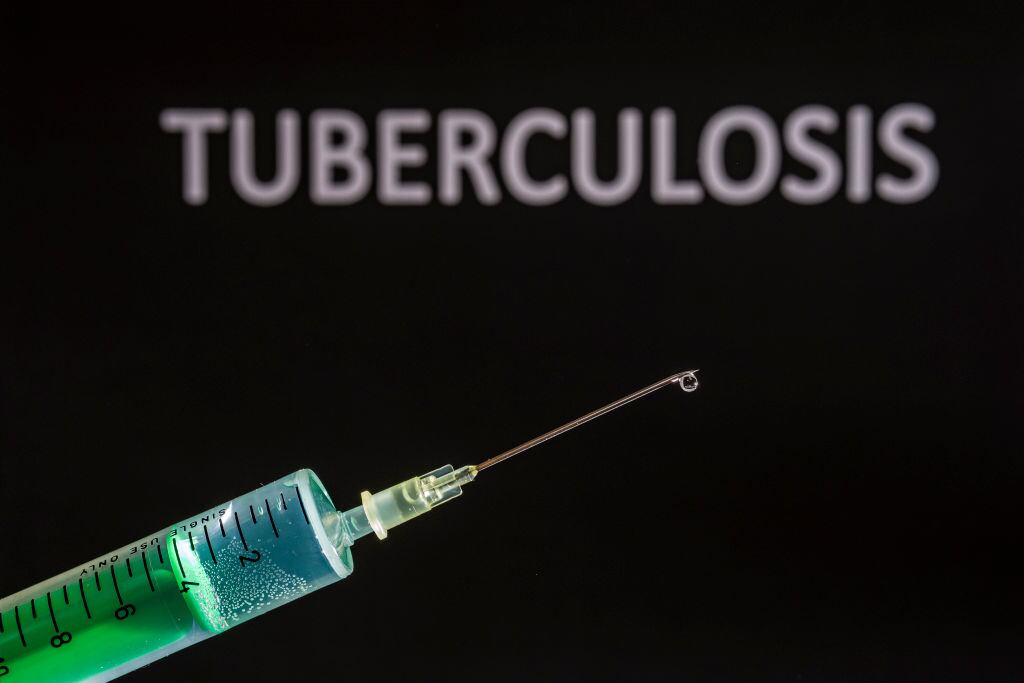 Imagen recreativa de una vacuna contra la tuberculosis