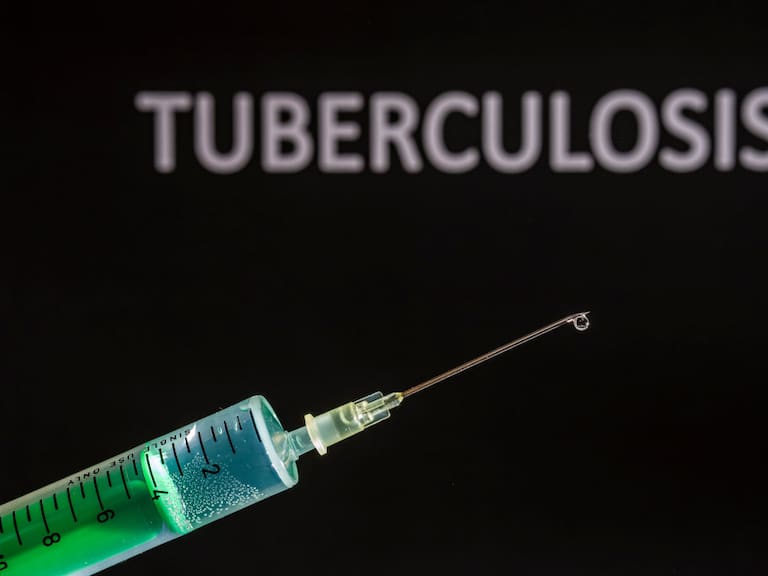 Imagen recreativa de una vacuna contra la tuberculosis