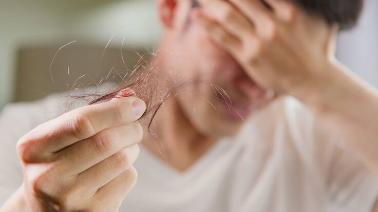 ¿Realmente se me puede caer el pelo por el estrés? Dermatólogo revela la verdad detrás de la creencia