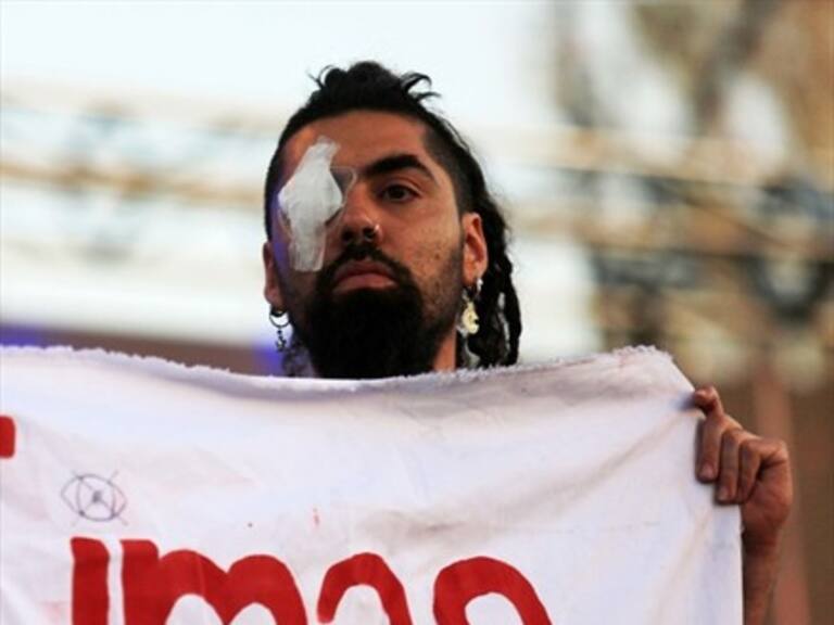 Médicos de la Universidad de Chile registraron al menos 182 casos de trauma ocular por balines