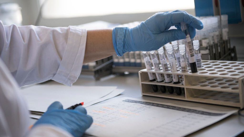 TURIN, ITALY - FEBRUARY 28: Blood and plasma samples used for the evaluation swabs for Coronavirus in the research laboratory of the Amedeo di Savoia hospital in Turin during of the Northern Italy In The Grip Of Covid-19 Coronavirus on February 28, 2020 in Turin, Italy. (Photo by Stefano Guidi/Getty Images)