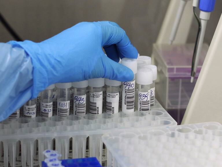 Covid-19 en Chile | Agencia Uno