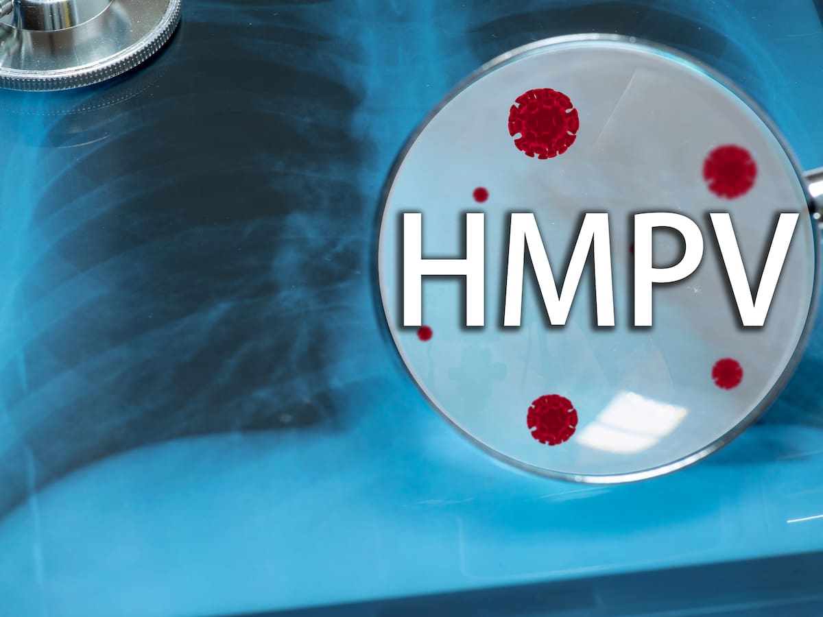 Podría confundirse con un resfrío común: así evoluciona el Metapneumovirus o HMPV, que ha despertado las alertas en el mundo