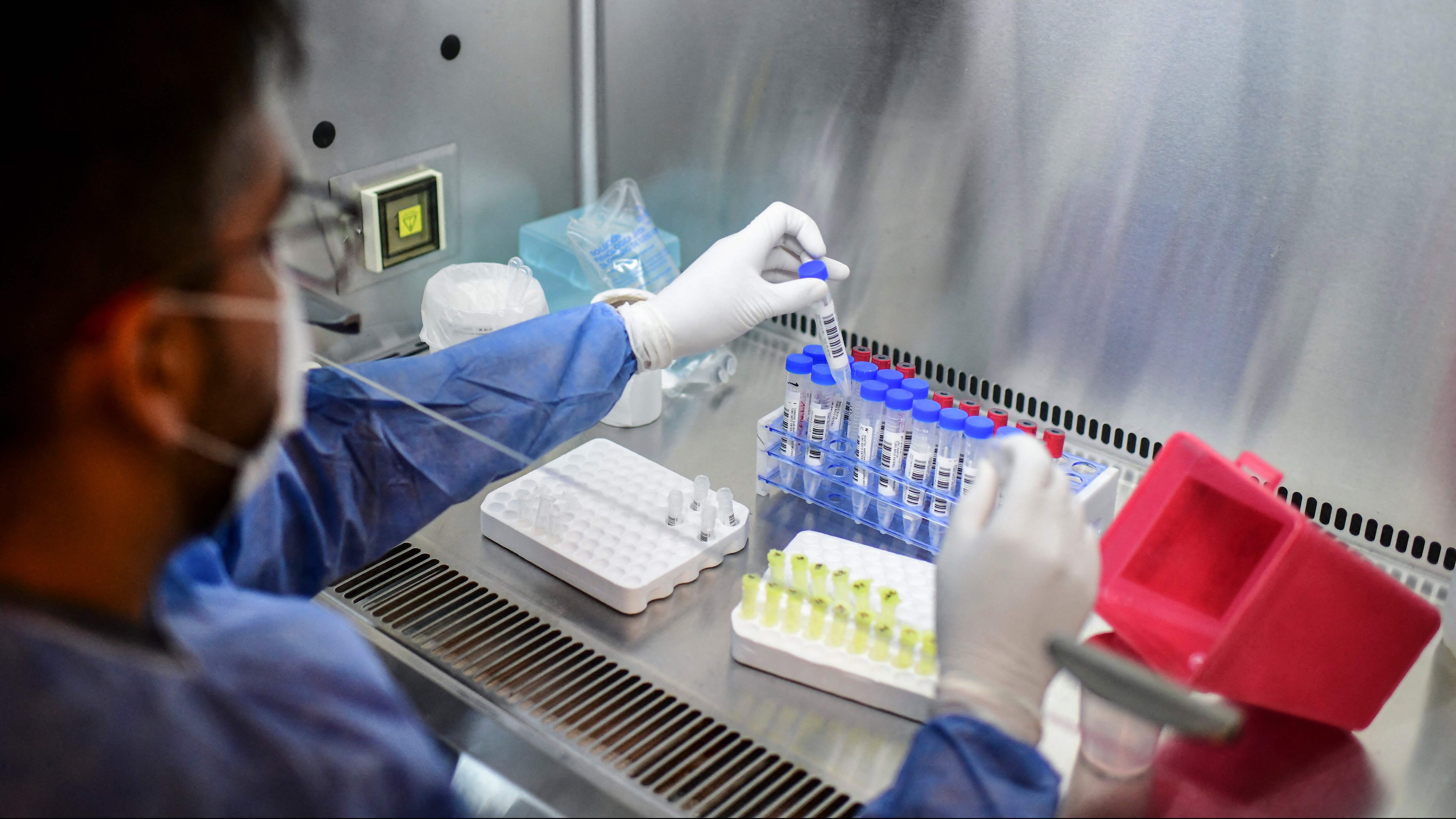 A health worker handles a COVID-19 test at the El Cruce - Dr Nestor Kirchner hospital in Florencio Varela, Argentina on April 13, 2021. - Latin America suffers a new upsurge of the covid-19 pandemic with records in contagions in Argentina and Uruguay, as worldwide immunisation campaigns will be affected in the United States and South Africa by the suspension of the Johnson & Johnson vaccine, which will also delay itrs distribution in Europe. (Photo by RONALDO SCHEMIDT / AFP) (Photo by RONALDO SCHEMIDT/AFP via Getty Images)