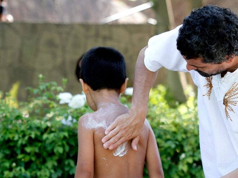 Verano 2023 y alta radiación en el país: ¿qué tipo de bloqueador solar debo usar?