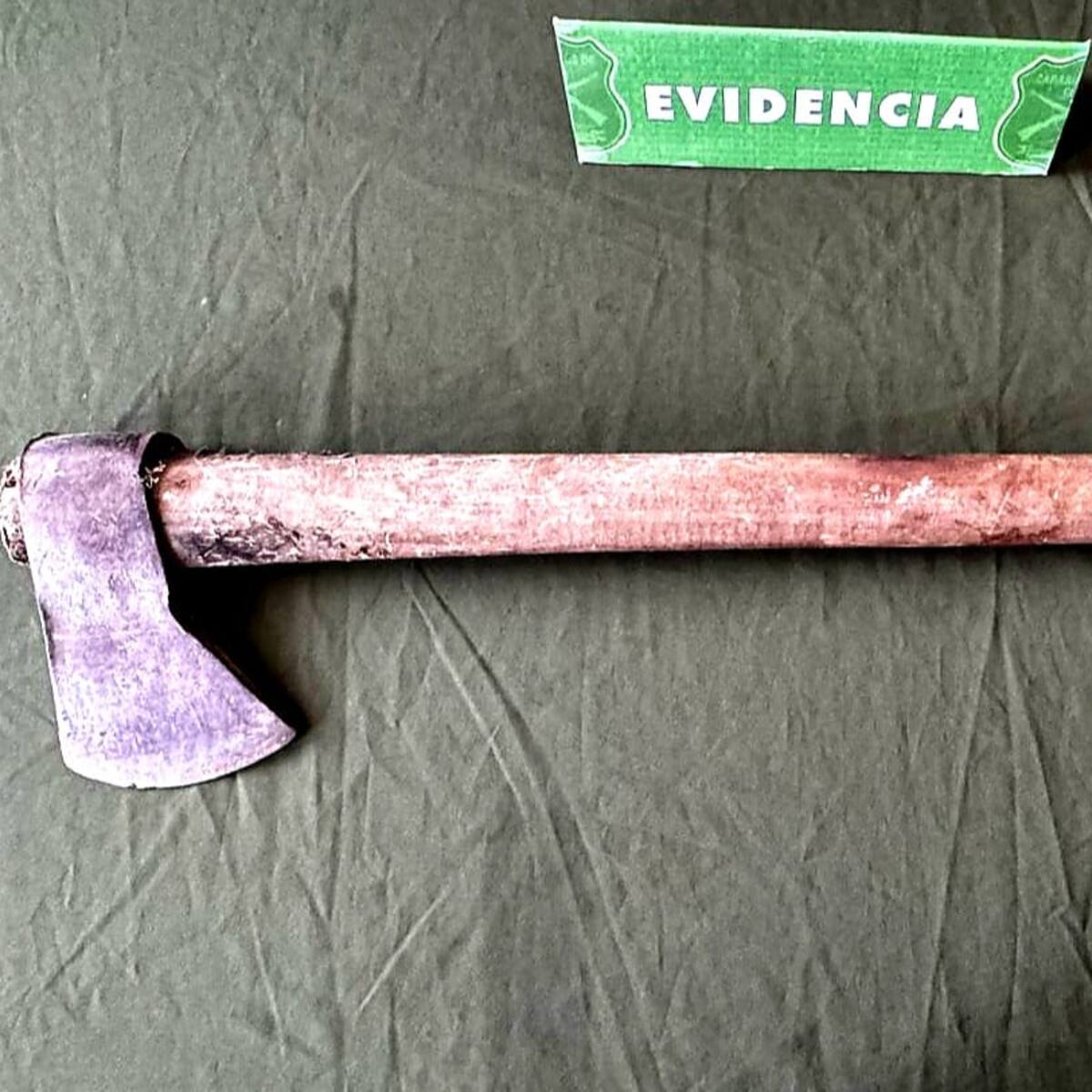 “Va a terminar lo que dejó inconcluso”: mujer atacada con un hacha en Puerto Montt denuncia nuevas amenazas