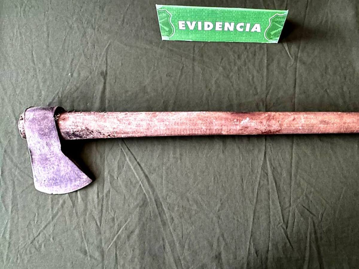 “Va a terminar lo que dejó inconcluso”: mujer atacada con un hacha en Puerto Montt denuncia nuevas amenazas