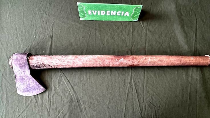 “Va a terminar lo que dejó inconcluso”: mujer atacada con un hacha en Puerto Montt denuncia nuevas amenazas